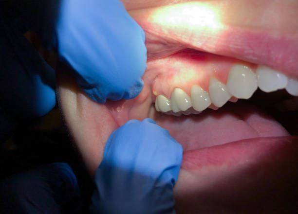 Best Cosmetic Emergency Dentistry in Rock Island, IL