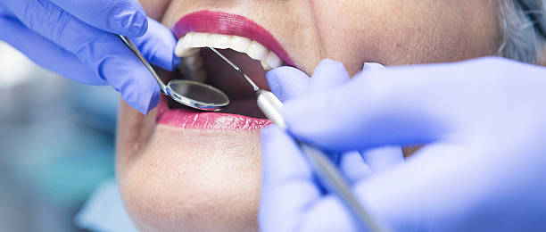 Best Emergency Dental Care for Broken or Chipped Teeth in Rock Island, IL